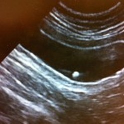 ultrasound stone bladder dufferin steeles animal hospital